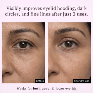 Instant Lift PDRN & Collagen Eye Patches