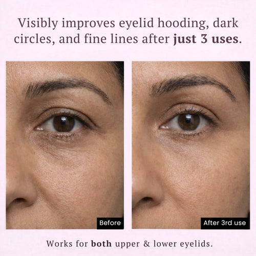 Instant Lift PDRN & Collagen Eye Patches